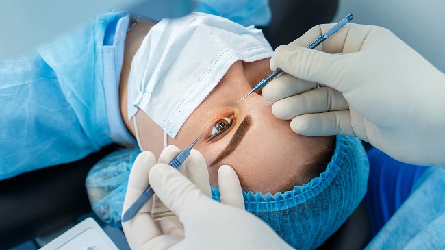 Insight into the Latest Advances in Eye Surgery in Singapore